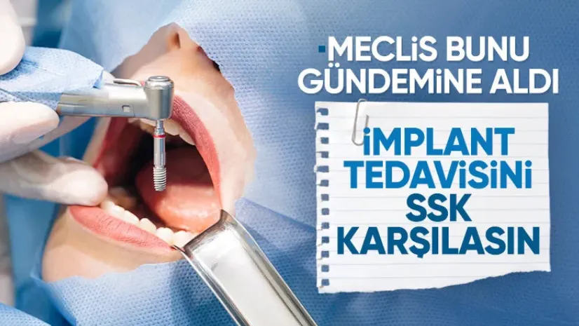 Diş tedavisinde yeni dönem: İmplant SSK kapsamına giriyor
