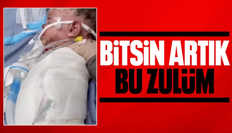İsrail zulmünün utanç karesi: Gazze