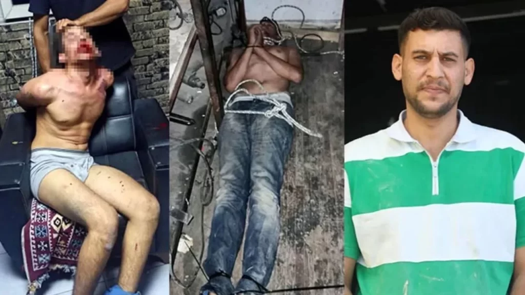 Böcek yedirip, dişlerini kırdılar; savcı 20’şer yıl hapis istedi